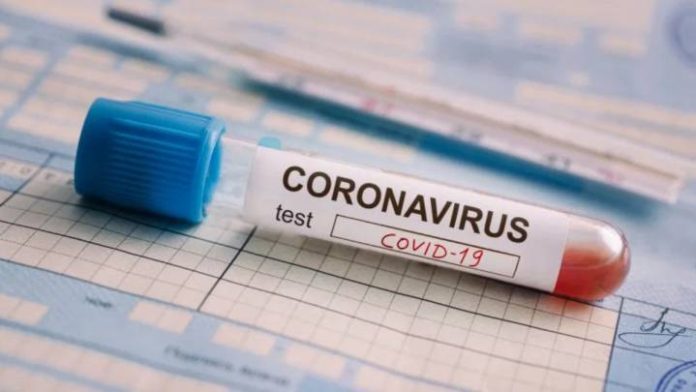 Coronavirus-pruebas-partidero-jalisco-enrique alfaro