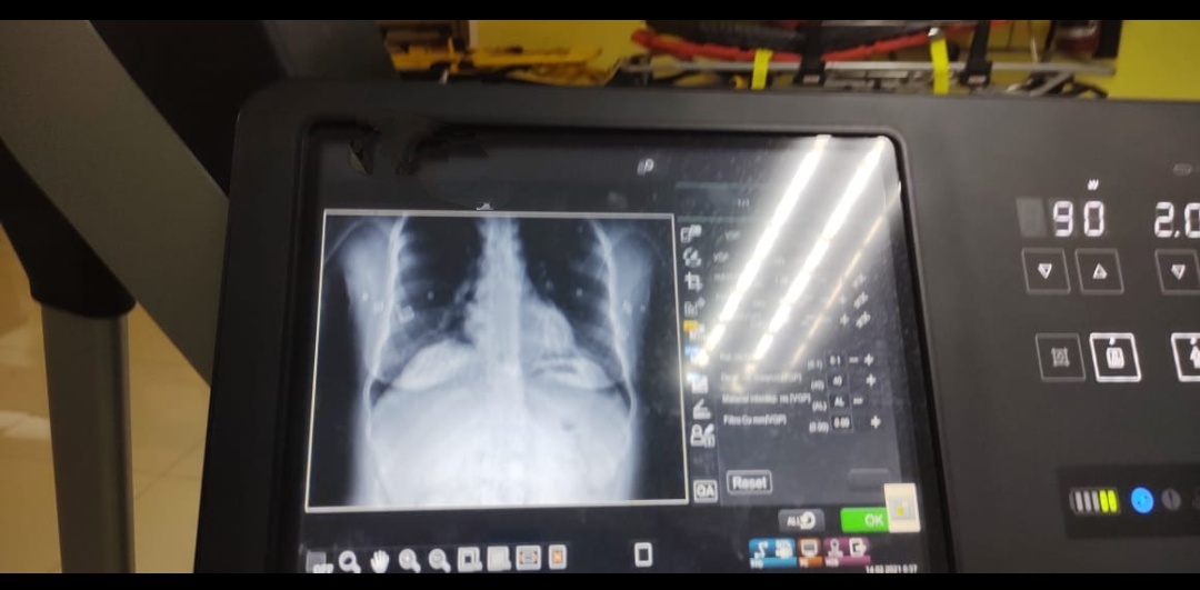 Radiografía de enfermera-covid-19